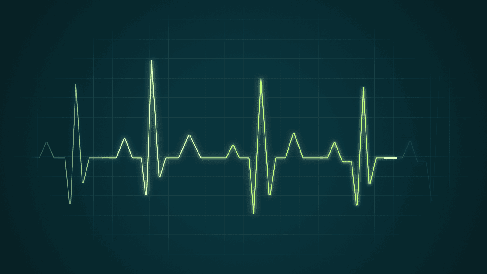 Why Kafka Platform Health Requires More Than Monitoring